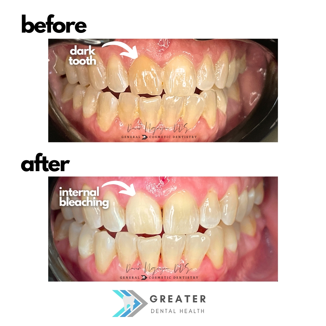Greater Dental Health