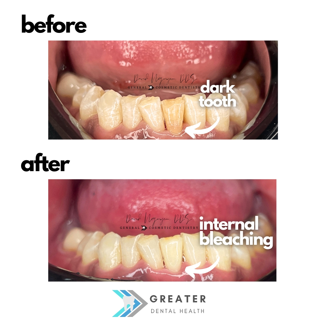 Greater Dental Health