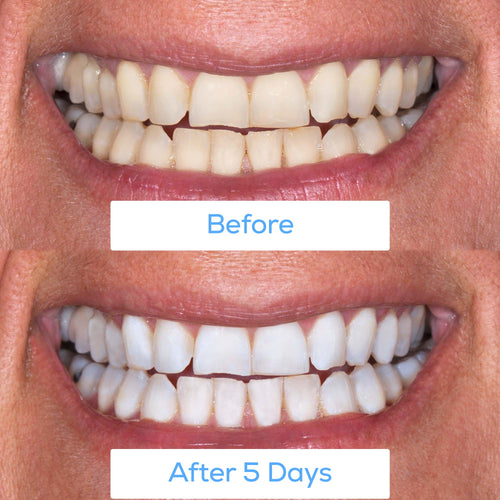 Greater Dental Health